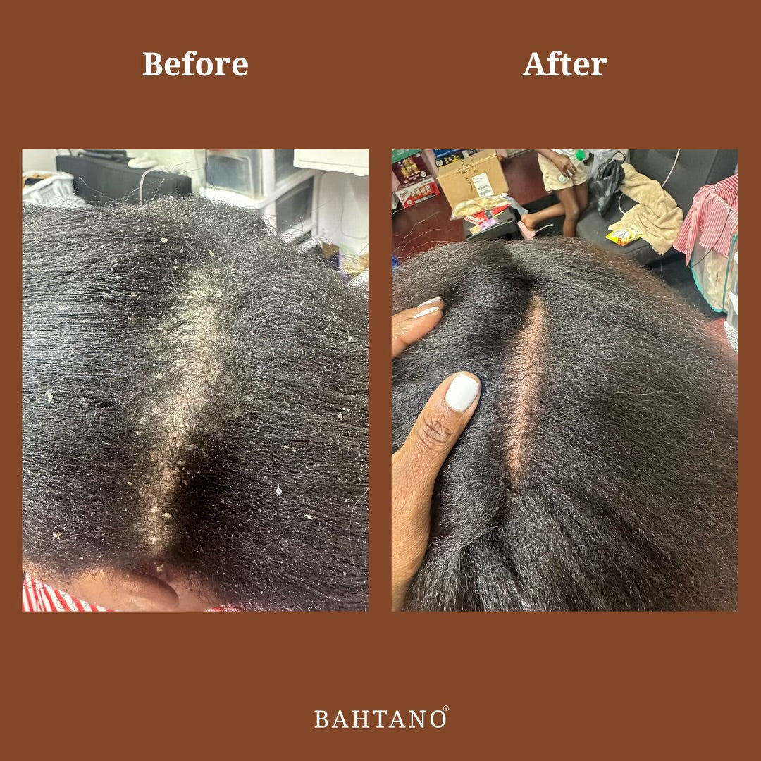Bahtano® Natural Hair Growth Oil