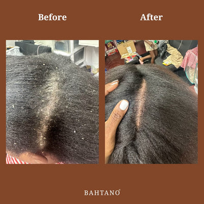 Bahtano® Natural Hair Growth Oil