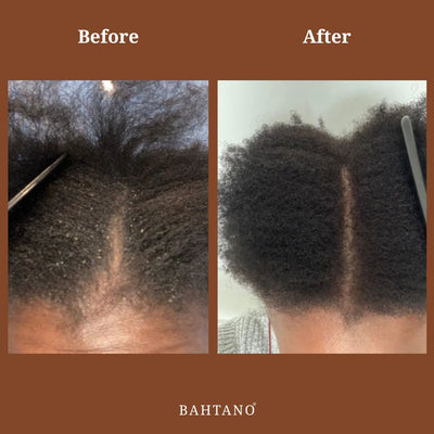 Bahtano® Natural Hair Growth Oil